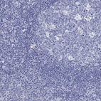 Anti-C4orf47 Antibody