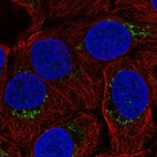 Anti-B4GALT4 Antibody