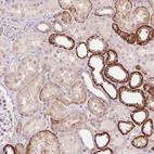 Anti-FNDC4 Antibody