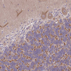 Immunohistochemical staining of human cerebellum shows strong cytoplasmic positivity in a subset of cells in granular layer.