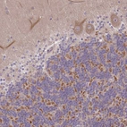 Immunohistochemical staining of human cerebellum shows strong cytoplasmic positivity in a subset of cells in granular layer.