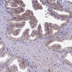 Immunohistochemical staining of human prostate shows moderate membranous positivity in glandular cells.