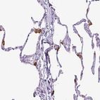 Immunohistochemical staining of human lung shows strong cytoplasmic positivity in macrophages.