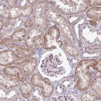 Immunohistochemical staining of human kidney shows weak to moderate cytoplasmic positivity in cells in tubules.