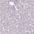 Immunohistochemical staining of human liver shows no positivity in hepatocytes as expected.