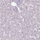 Immunohistochemical staining of human liver shows no positivity in hepatocytes as expected.