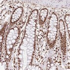 Immunohistochemical staining of human colon shows very strong nuclear positivity in glandular cells.