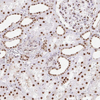 Immunohistochemical staining of human kidney shows strong nuclear positivity in cells in tubules.