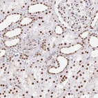 Immunohistochemical staining of human kidney shows strong nuclear positivity in cells in tubules.