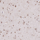 Immunohistochemical staining of human cerebral cortex shows moderate nuclear positivity in neurons.