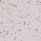 Immunohistochemical staining of human cerebral cortex shows moderate nuclear positivity in neurons.