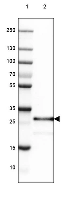 Lane 1: Marker [kDa] 250, 130, 100, 70, 55, 35, 25, 15, 10_br/_Lane 2: Human Liver tissue
