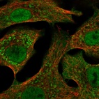 Anti-CYP24A1 Antibody