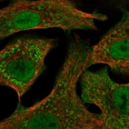 Anti-CYP24A1 Antibody