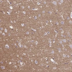 Immunohistochemical staining of human cerebral cortex shows high expression.