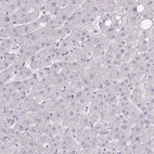 Immunohistochemical staining of human liver shows low expression as expected.