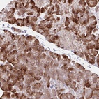 Anti-ZNF383 Antibody