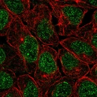 Immunofluorescent staining of human cell line RT4 shows localization to nucleus & nuclear membrane.