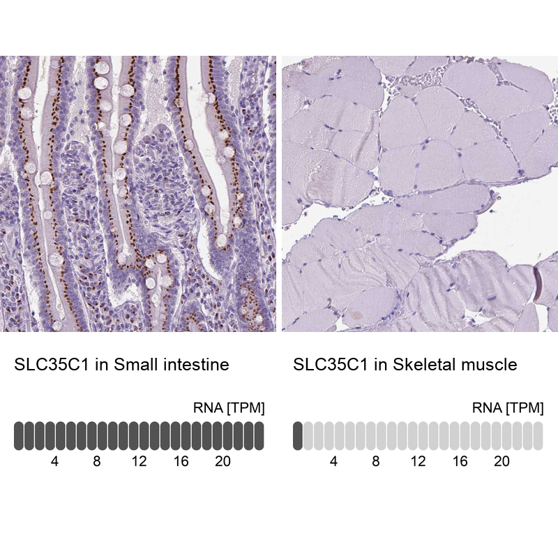Anti-SLC35C1 Antibody