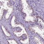 Immunohistochemical staining of human prostate shows strong positivity in Golgi apparatus in glandular cells.