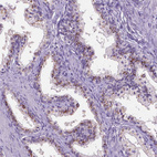 Anti-SLC35C1 Antibody