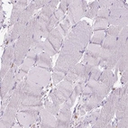 Immunohistochemical staining of human skeletal muscle shows no positivity in myocytes as expected.