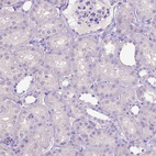 Immunohistochemical staining of human kidney shows no positivity in cells in tubules as expected.