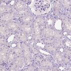 Immunohistochemical staining of human kidney shows no positivity in cells in tubules as expected.