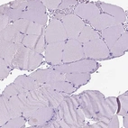 Immunohistochemical staining of human skeletal muscle shows no positivity in myocytes as expected.