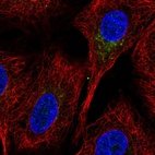 Immunofluorescent staining of human cell line A549 shows localization to the Golgi apparatus.