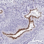 Anti-INAFM1 Antibody