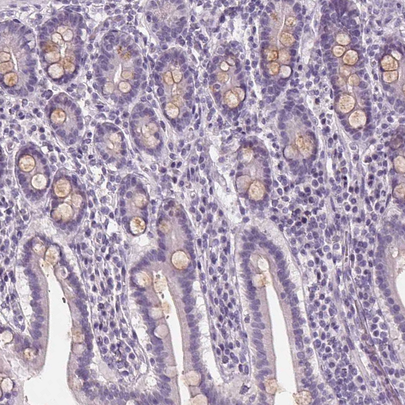 Anti-PLA2G2E Antibody