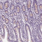 Anti-PLA2G2E Antibody