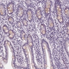 Anti-PLA2G2E Antibody