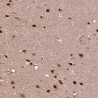 Immunohistochemical staining of human cerebral cortex shows strong nuclear positivity in neurons.