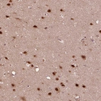 Immunohistochemical staining of human cerebral cortex shows strong nuclear positivity in neurons.