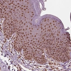 Immunohistochemical staining of human skin shows moderate nuclear positivity in squamous epithelial cells.