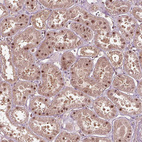 Immunohistochemical staining of human kidney shows moderate nuclear positivity in cells in tubules.