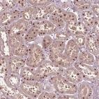 Immunohistochemical staining of human kidney shows moderate nuclear positivity in cells in tubules.