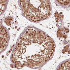 Immunohistochemical staining of human testis shows strong nuclear positivity in cells in seminiferous ducts.