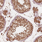 Anti-PSMC5 Antibody