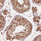Immunohistochemical staining of human testis shows strong nuclear positivity in cells in seminiferous ducts.