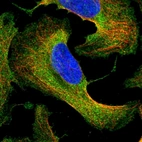 Immunofluorescent staining of human cell line U-2 OS shows localization to plasma membrane & cytosol.
