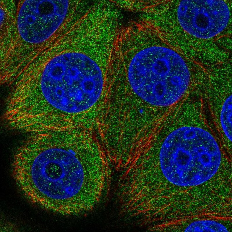 Anti-EIF2B5 Antibody