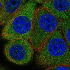 Anti-EIF2B5 Antibody