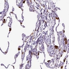Immunohistochemical staining of human lung shows strong cytoplasmic positivity in macrophages.