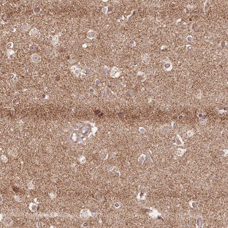 Anti-SPRED2 Antibody