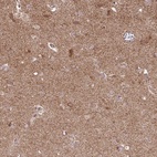 Anti-SPRED2 Antibody
