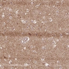 Anti-SPRED2 Antibody