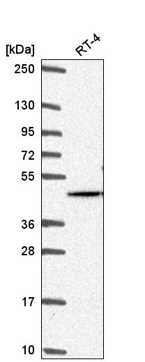 Anti-AKT2 Antibody